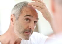 How to Prepare for Hair Transplant (Men) – 2024 Guide